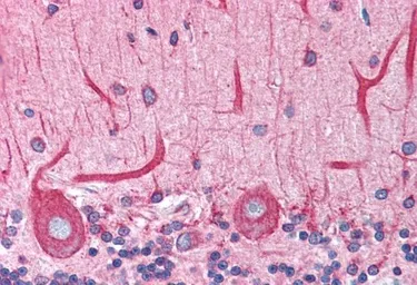 Anti-BCAP31 antibody, C-term used in IHC (Paraffin sections) (IHC-P). GTX10924