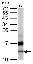 Anti-CRIPT antibody [N1C3] used in Western Blot (WB). GTX109246