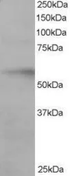 Anti-IRF6 antibody, C-term used in Western Blot (WB). GTX10925