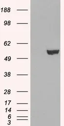 Anti-IRF6 antibody, C-term used in Western Blot (WB). GTX10925