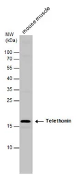 Anti-Telethonin antibody [N1C3] used in Western Blot (WB). GTX109265