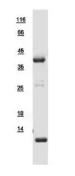 Human Tropomyosin 2 protein, His tag. GTX109268-pro