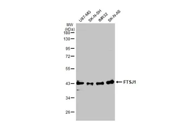 Anti-FTSJ1 antibody used in Western Blot (WB). GTX109271