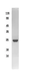 Human Troponin I skeletal muscle protein, His tag. GTX109272-pro