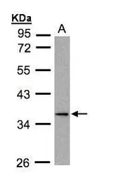 Anti-MKP4 antibody [C2C3], C-term used in Western Blot (WB). GTX109288
