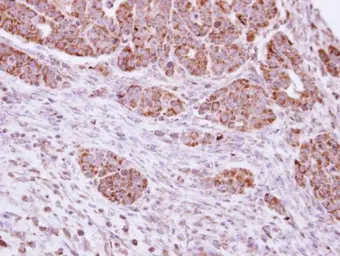 Anti-DUSP7 antibody [C1C3] used in IHC (Paraffin sections) (IHC-P). GTX109289