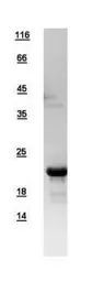 Human TTDN1 protein, His tag. GTX109301-pro