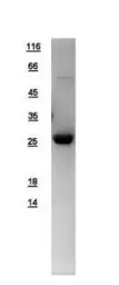 Human DNase I protein, His tag. GTX109306-pro