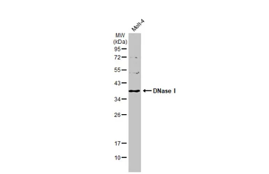 Anti-DNase I antibody [N1C3] used in Western Blot (WB). GTX109306