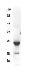 Human SelS protein, His tag. GTX109311-pro