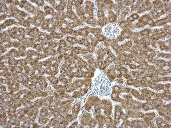 Anti-EPHX1 antibody used in IHC (Paraffin sections) (IHC-P). GTX109360