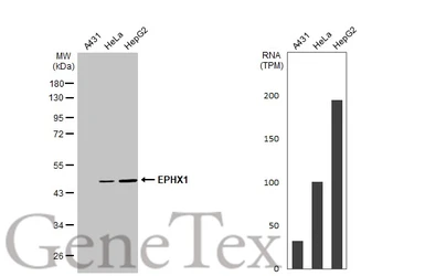 Anti-EPHX1 antibody used in Western Blot (WB). GTX109360