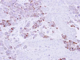Anti-EPHX1 antibody used in IHC (Paraffin sections) (IHC-P). GTX109360