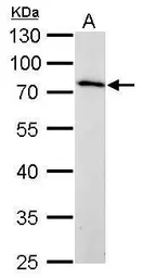 Anti-MMP16 antibody used in Western Blot (WB). GTX109378