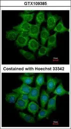 Anti-UBE4B antibody [C2C3], C-term used in Immunocytochemistry/ Immunofluorescence (ICC/IF). GTX109385