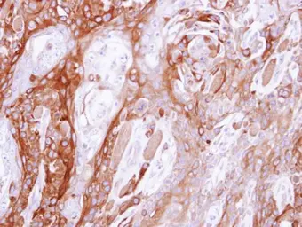 Anti-UBE4B antibody [C2C3], C-term used in IHC (Paraffin sections) (IHC-P). GTX109385