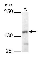 Anti-UBE4B antibody [C2C3], C-term used in Western Blot (WB). GTX109385
