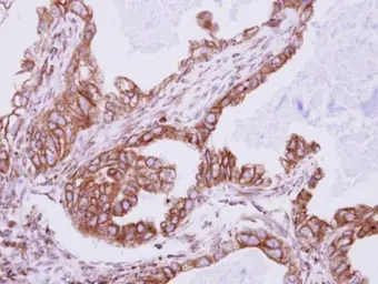 Anti-IFT80 antibody used in IHC (Paraffin sections) (IHC-P). GTX109393