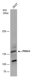 Anti-PHKA1 antibody [C2C3], C-term used in Western Blot (WB). GTX109401