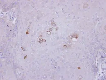 Anti-PHKA1 antibody [C2C3], C-term used in IHC (Paraffin sections) (IHC-P). GTX109401