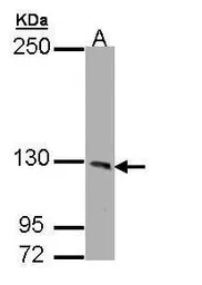 Anti-PHKA1 antibody [C2C3], C-term used in Western Blot (WB). GTX109401