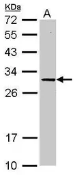 Anti-SLC25A15 antibody [N1C3-2] used in Western Blot (WB). GTX109432
