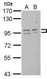 Anti-FXR2 antibody used in Western Blot (WB). GTX109465