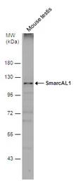 Anti-SmarcAL1 antibody used in Western Blot (WB). GTX109468