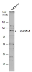 Anti-SmarcAL1 antibody used in Western Blot (WB). GTX109468