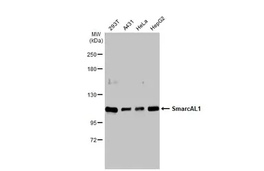 Anti-SmarcAL1 antibody used in Western Blot (WB). GTX109468