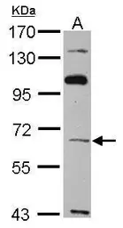 Anti-TBX4 antibody [C1C3] used in Western Blot (WB). GTX109470