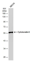 Anti-Cytokeratin 8 antibody [N1N3] used in Western Blot (WB). GTX109489