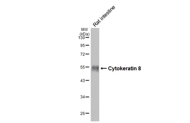 Anti-Cytokeratin 8 antibody [N1N3] used in Western Blot (WB). GTX109489