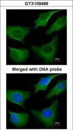 Anti-Cytokeratin 8 antibody [N1N3] used in Immunocytochemistry/ Immunofluorescence (ICC/IF). GTX109489