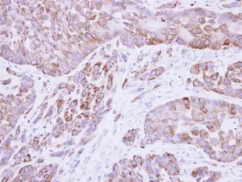 Anti-Cytokeratin 8 antibody [N1N3] used in IHC (Paraffin sections) (IHC-P). GTX109489