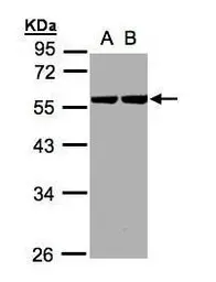 Anti-Cytokeratin 8 antibody [N1N3] used in Western Blot (WB). GTX109489