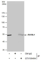 Anti-RUVBL1 antibody used in Immunoprecipitation (IP). GTX109494