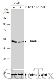 Anti-RUVBL1 antibody used in Western Blot (WB). GTX109494