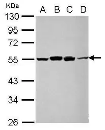 Anti-RUVBL1 antibody used in Western Blot (WB). GTX109494