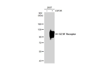 Anti-GCSF Receptor antibody [N2C1], Internal used in Western Blot (WB). GTX109503