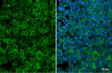 Anti-GCSF Receptor antibody [N2C1], Internal used in Immunocytochemistry/ Immunofluorescence (ICC/IF). GTX109503