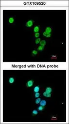 Anti-RASAL1 antibody [C1C3] used in Immunocytochemistry/ Immunofluorescence (ICC/IF). GTX109520