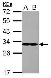 Anti-EIF2B1 antibody used in Western Blot (WB). GTX109525
