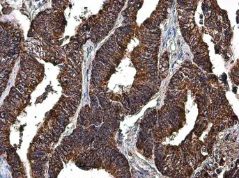 Anti-LRP130 antibody [N3C2], Internal used in IHC (Paraffin sections) (IHC-P). GTX109558