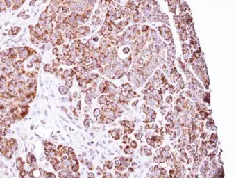 Anti-LRP130 antibody [N3C2], Internal used in IHC (Paraffin sections) (IHC-P). GTX109558