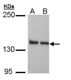 Anti-LRP130 antibody [N3C2], Internal used in Western Blot (WB). GTX109558