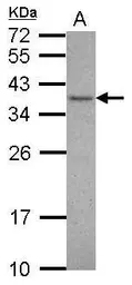 Anti-VAX1 antibody used in Western Blot (WB). GTX109559