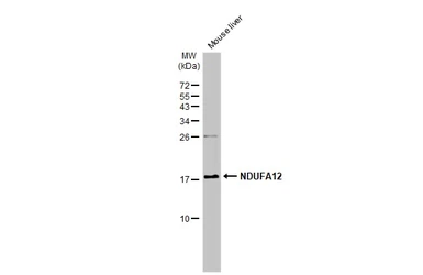 Anti-NDUFA12 antibody [N1C3] used in Western Blot (WB). GTX109567