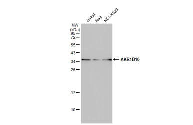 Anti-AKR1B10 antibody used in Western Blot (WB). GTX109571