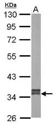 Anti-GRHPR antibody [N1C3] used in Western Blot (WB). GTX109575